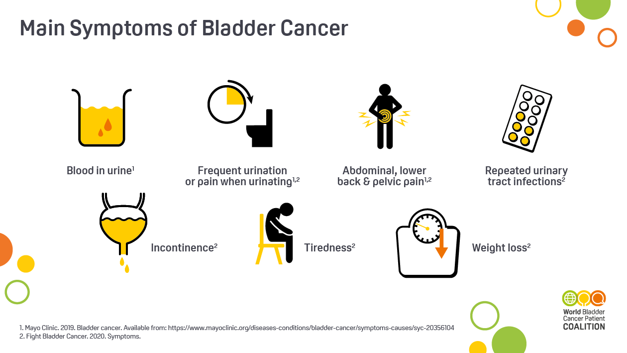 7 Signs of Bladder Cancer That You Shouldn’t Ignore - La Vie Executive ...